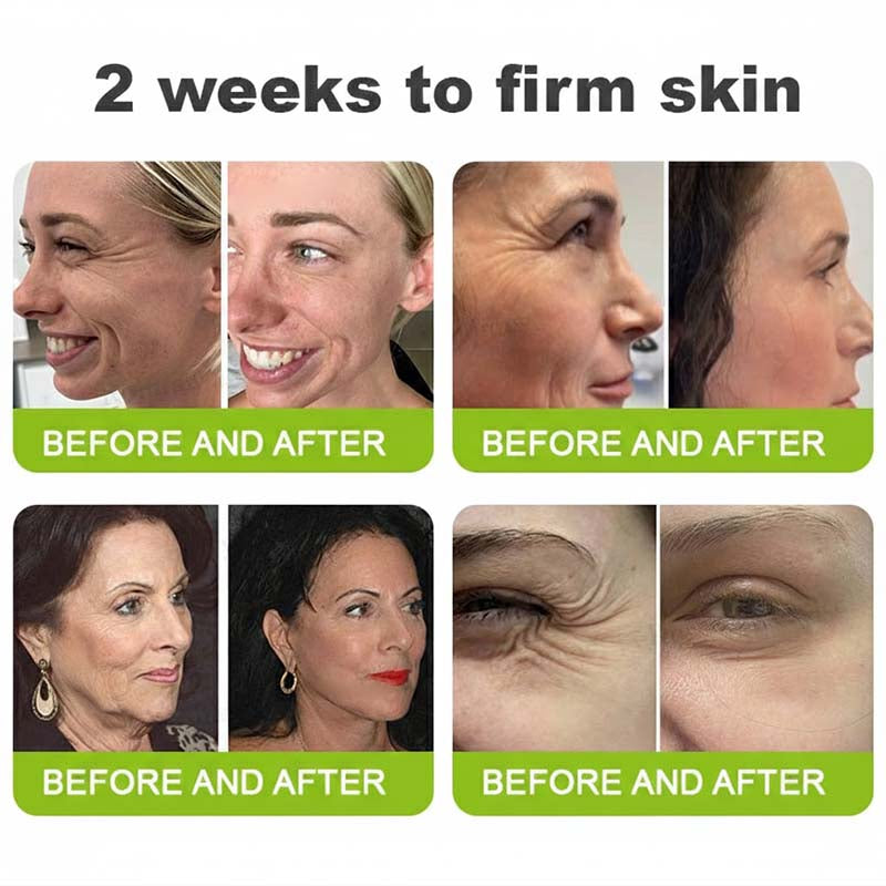 👨‍⚕️Made and shipped from the USA 💫LOVILDS® moringa & Vita-A Retinol Shot Wrinkle-Lift Tightening cream -Last Day Promotion 70% OFF