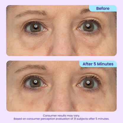 Instant Lift Eye Gel — Reduce the Look of Eye Bags in Minutes