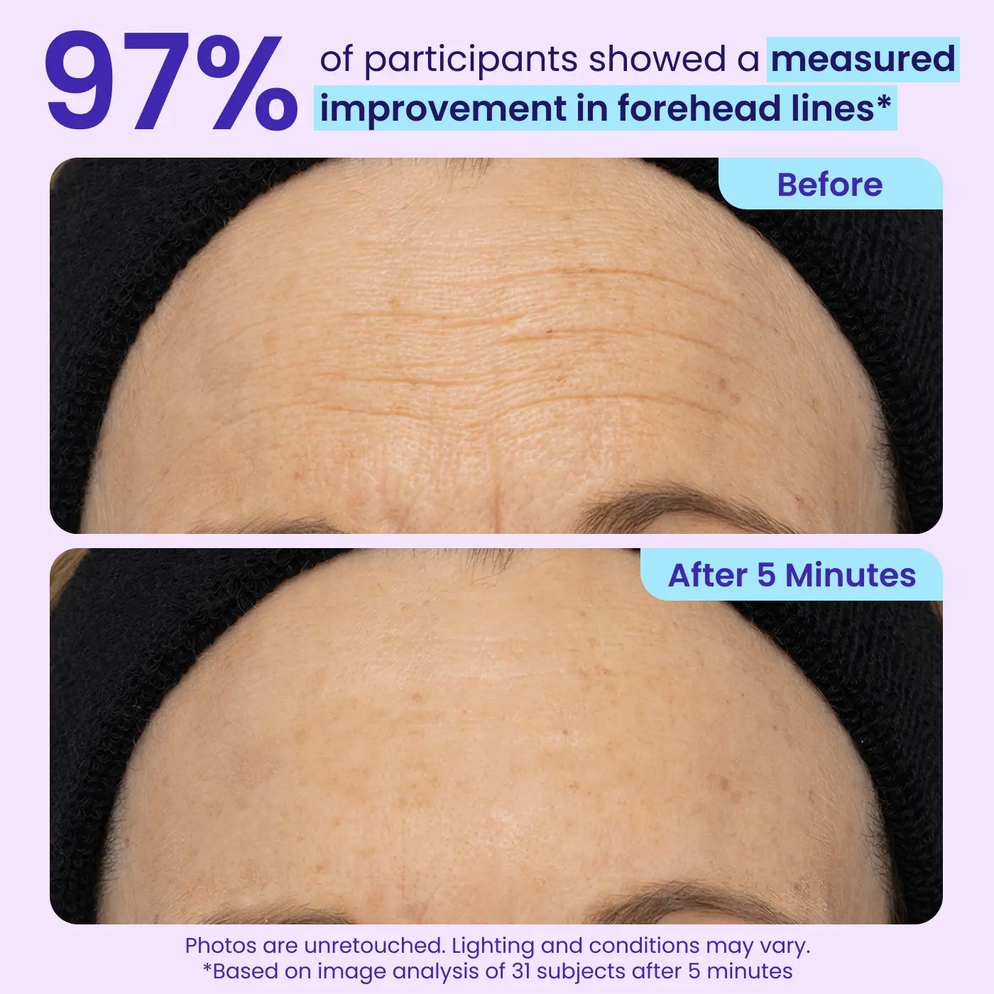 Instant Lift Eye Gel — Reduce the Look of Eye Bags in Minutes