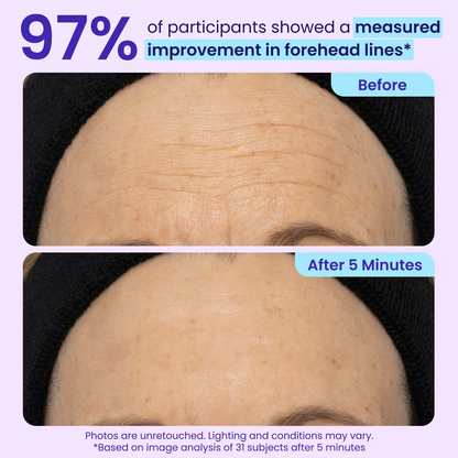 Instant Lift Eye Gel — Reduce the Look of Eye Bags in Minutes