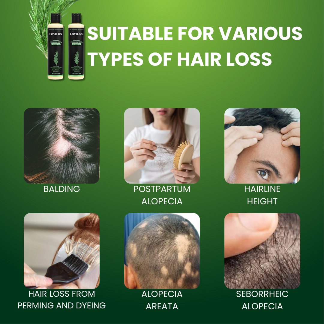 🔥Final 3 Hours: 70%OFF🔥LOVILDS® Rosemary Hydrolyzed Keratin Shampoo