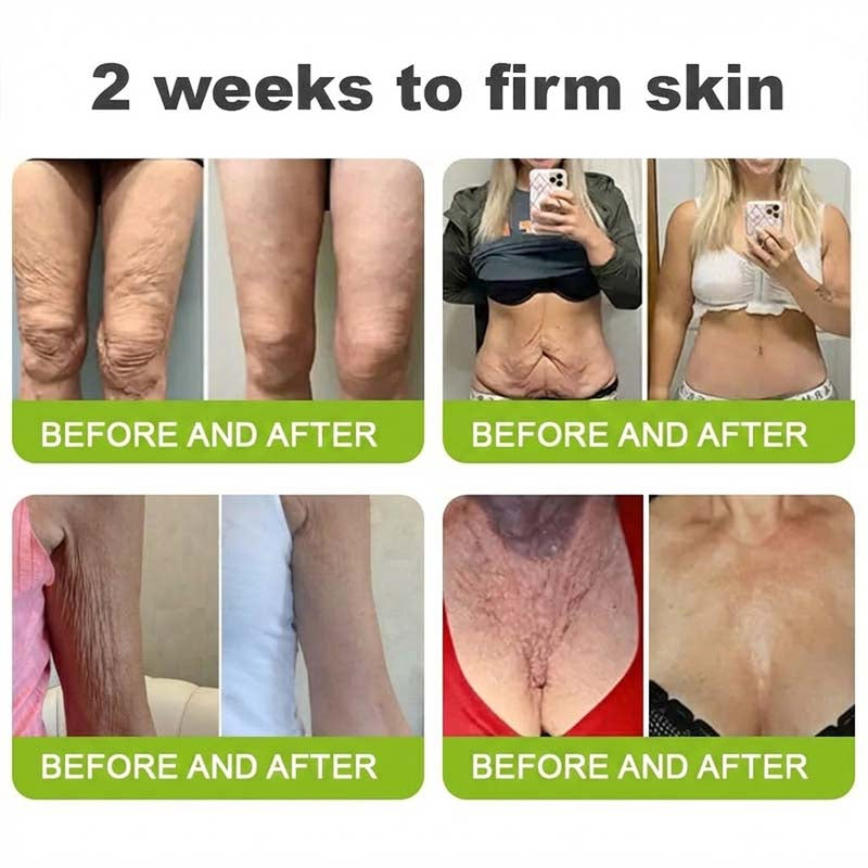 👨‍⚕️Made and shipped from the USA 💫LOVILDS® moringa & Vita-A Retinol Shot Wrinkle-Lift Tightening cream -Last Day Promotion 70% OFF