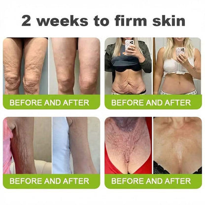 👨‍⚕️Made and shipped from the USA 💫LOVILDS® moringa & Vita-A Retinol Shot Wrinkle-Lift Tightening cream -Last Day Promotion 70% OFF