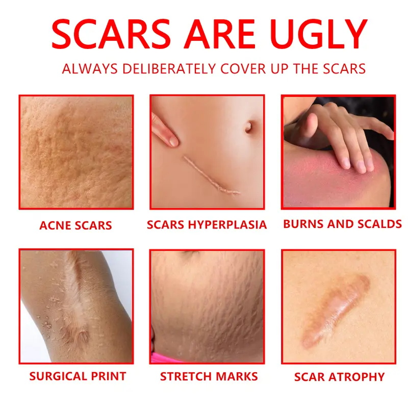 🌸 Mother’s Day Special -60% OFF💧 Professional Scar Repair Gel – For Acne, Surgery, Burns & More