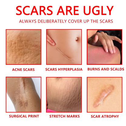 🌸 Mother’s Day Special -60% OFF💧 Professional Scar Repair Gel – For Acne, Surgery, Burns & More