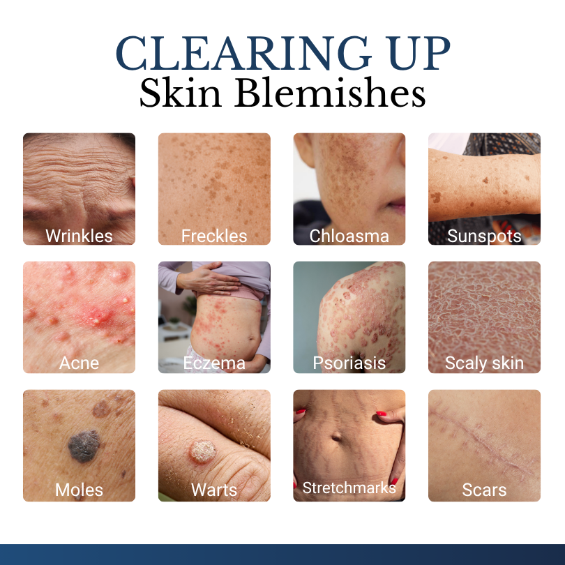 Clinclii® DermFixPro 2-in-1 Microneedle & Hydrocolloid Patch