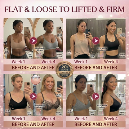 💖 Official Store | Nexisify™ CURVLIFT Breast & Hip Micro-Needle Patch