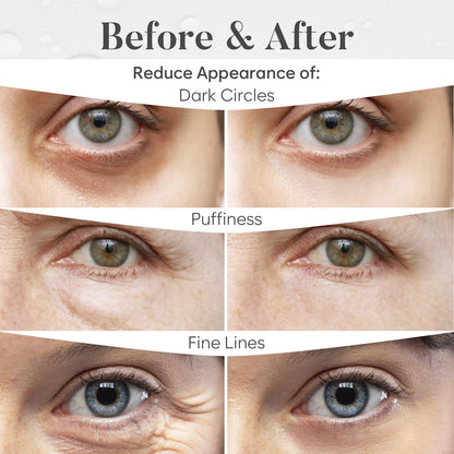 ✨Enjoy 49% OFF today: Collagen Infusion Tightening Eye Patches: A Revolution for Your Under - Eyes