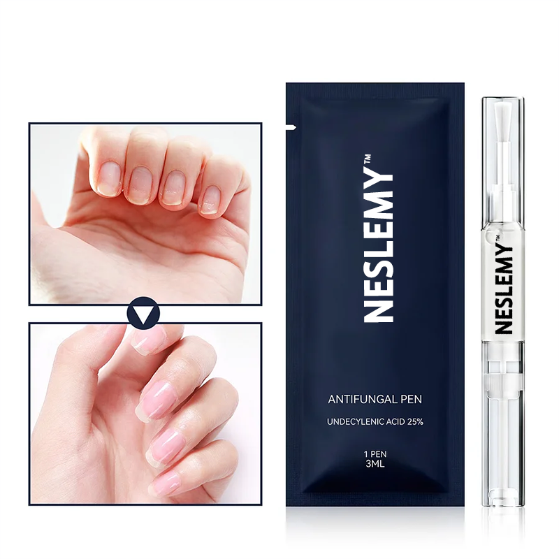 (⏳LAST DAY 70% OFF)NESLEMY™ Antifungal Pen – 25% Undecylenic Acid Treatment for Athlete’s Foot & Skin Fungus 🦶