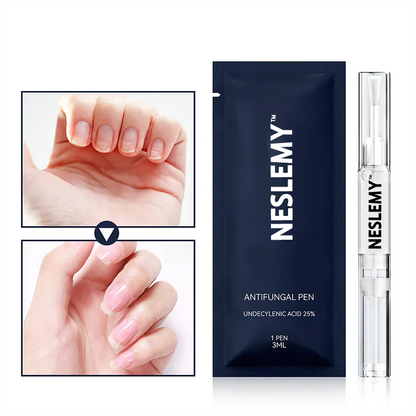 (⏳LAST DAY 70% OFF)NESLEMY™ Antifungal Pen – 25% Undecylenic Acid Treatment for Athlete’s Foot & Skin Fungus 🦶