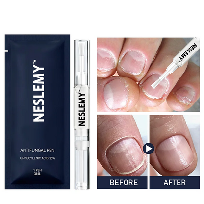 (⏳LAST DAY 70% OFF)NESLEMY™ Antifungal Pen – 25% Undecylenic Acid Treatment for Athlete’s Foot & Skin Fungus 🦶