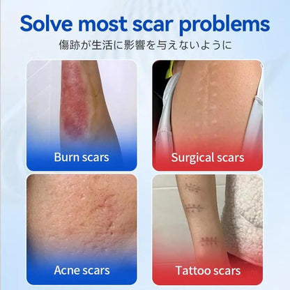 🔥Limited-time 60% sale-NESLEMY™  Silicone Scar Gel, Rawatan Parut Jerawat, Boleh Guna Semula