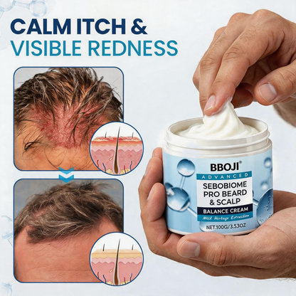 🔥 FLAKE-FREE SKIN IN 7 DAYS BBOJI® SeboBiome Pro Beard & Scalp Cream 🌱 Reduces Itch & Flakes — No Greasy Residue!