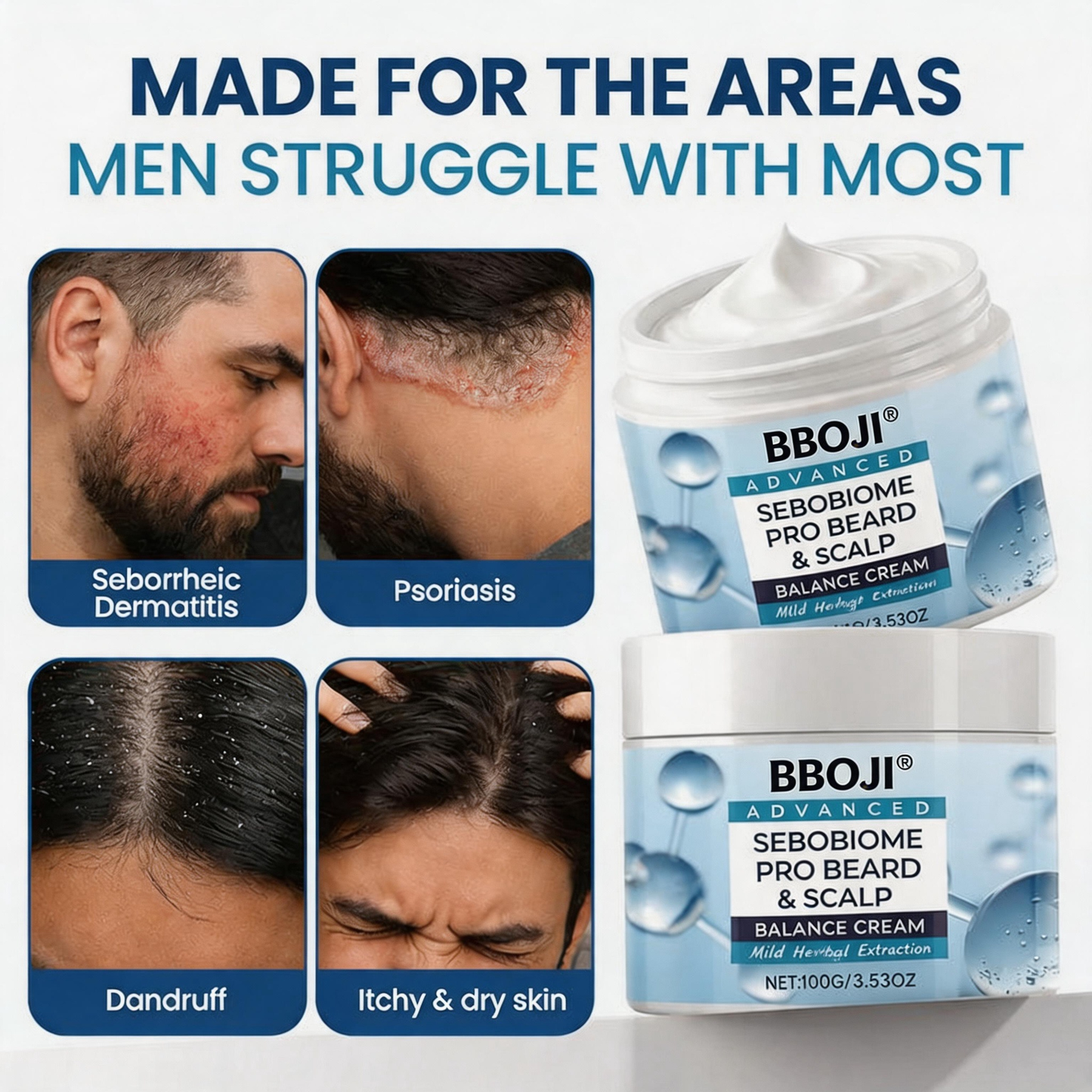 🔥 FLAKE-FREE SKIN IN 7 DAYS BBOJI® SeboBiome Pro Beard & Scalp Cream 🌱 Reduces Itch & Flakes — No Greasy Residue!